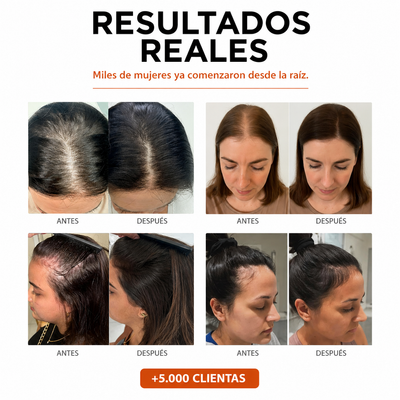 Sérum capilar anticaída